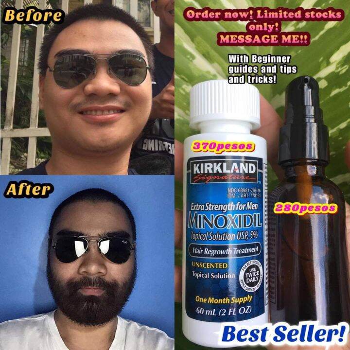 Kirkland Minoxidil Box Bottles Lazada Ph