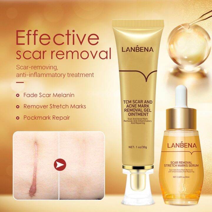 Original Lanbena Tcm Scar And Acne Mark Removal Lazada Ph