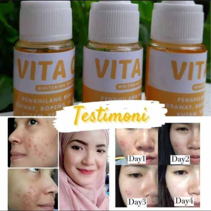 Serum Glowing Original Vita Oil Serum Serum Original Mencerahkan