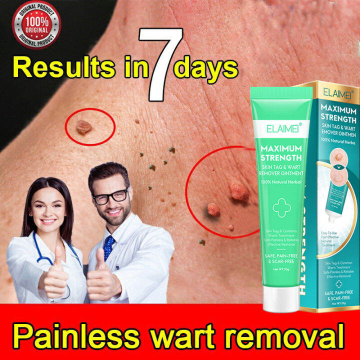 G Elaimei Warts Remover Original Cream Remover Wart Ointment Original