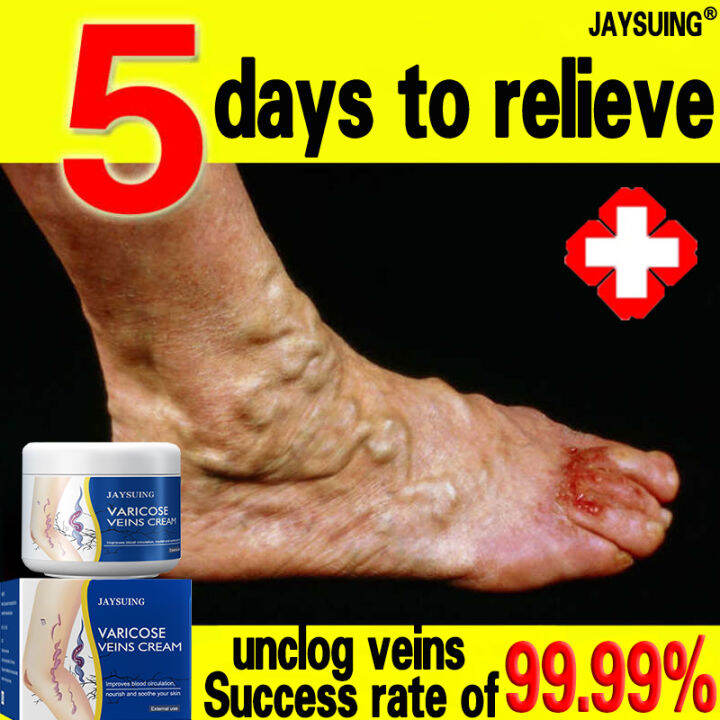 JAYSUING Varicose Vein Cream 50g Venous Massage Ointment Earthworm Leg