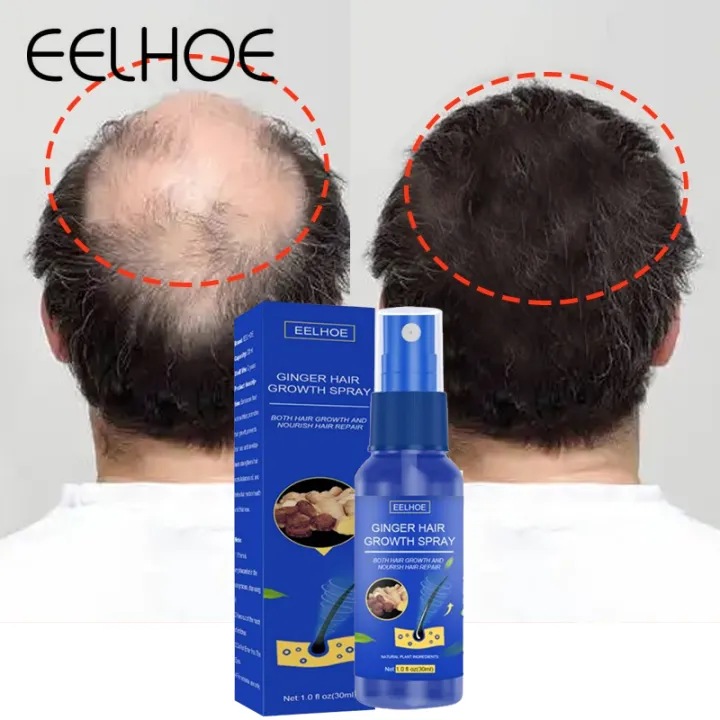 Eelhoe Ginger Hair Growth Spray Serum Anti Hair Loss Products Fast