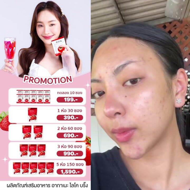 Akane lyco Brink ผงมะเขอเทศผสมกลตารสสตอเบอรตวดงTiktok Lazada