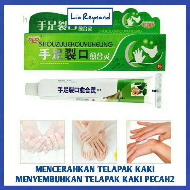 Cream Obat Telapak Kaki Kapalan Telapak Kaki Pecah Pecah Telapak