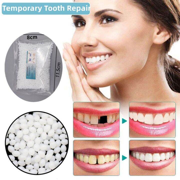 G Resin Falseteeth Glue Temporary Tooth Replacement Solid Glue Teeth