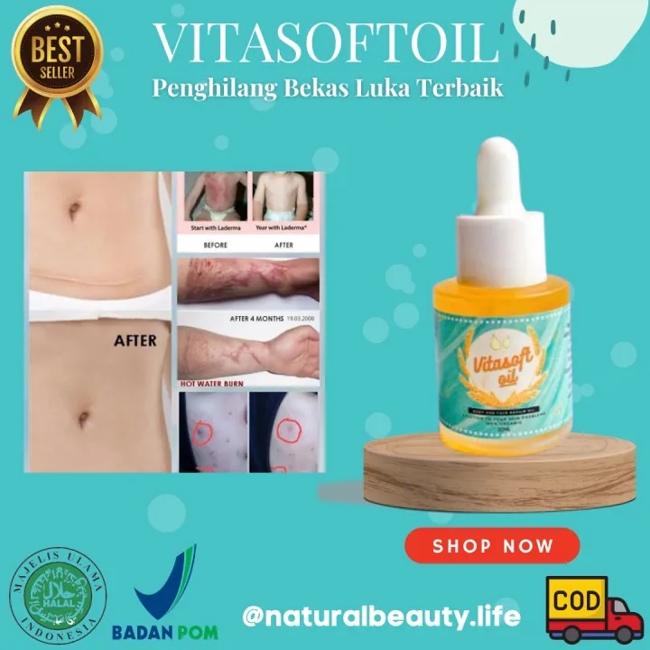 VITASOFTOIL ORIGINAL Penghilang Keloid Dan Bekas Luka Ampuh 100