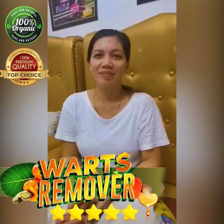 FLASH SALE Warts Remover KASOY AID Gamot Sa Kulugo Warts Buni An