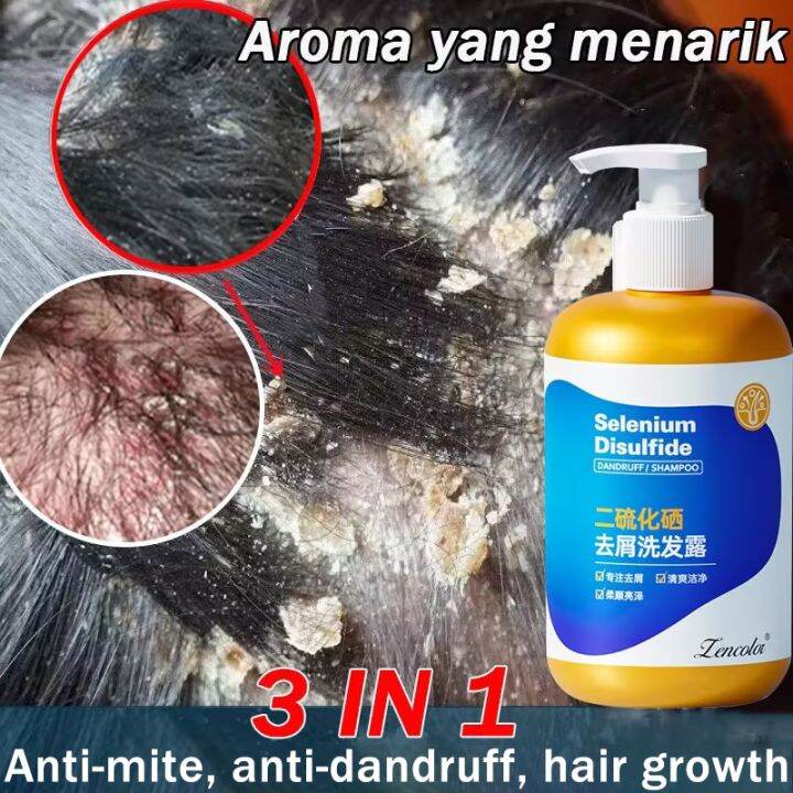 Anti Dandruff Shampoo Ml Selenium Disulfide Dandruff Syampu Rambut