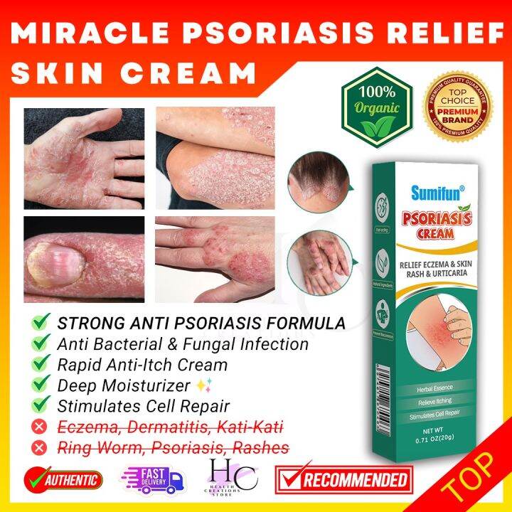 Sumifun Psoriasis Treatment Cream Anti Itch Cream For Skin Gamot Sa