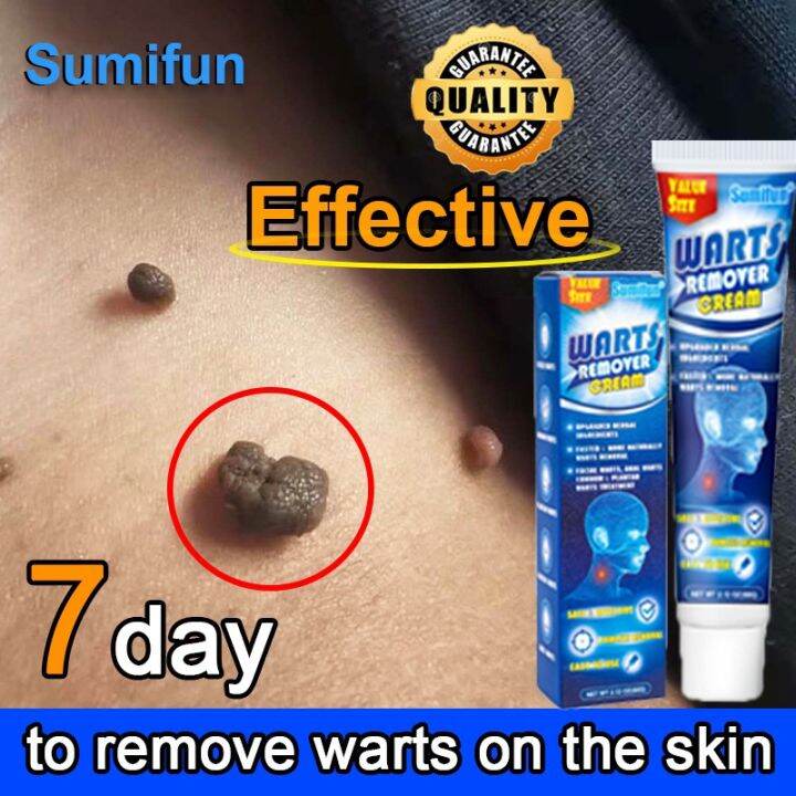 Sumifun Warts Remover Original Warts Remover Warts Remover Cream Skin