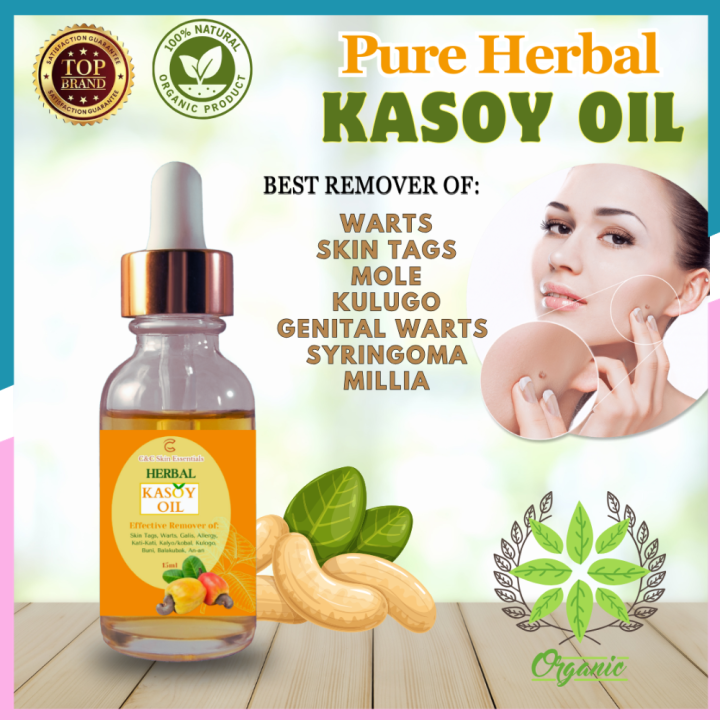 Pure Kasoy Oil Your Original Organic And Effective Solution Remover