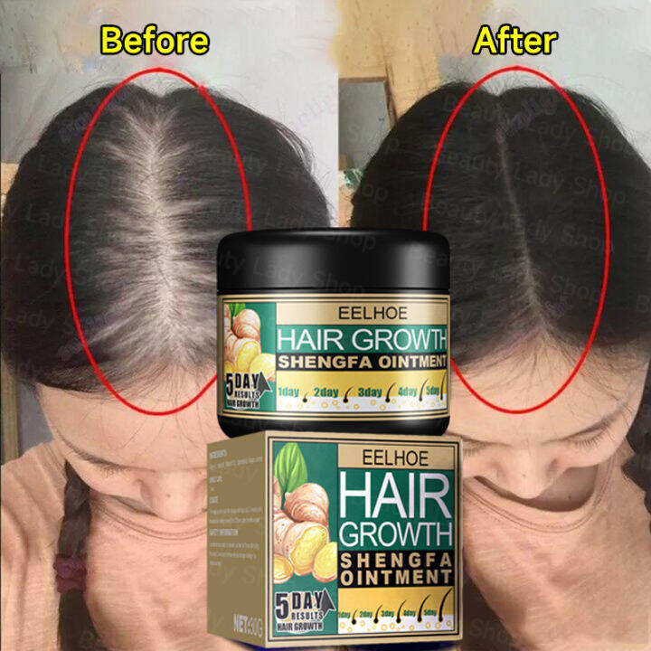 Eelhoe 5 Days Ginger Hair Growth Care Ointment 100 Natural Ginger Hair