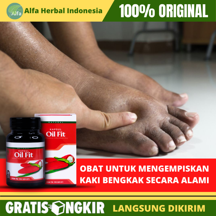 Obat Pengempis Kaki Bengkak Bengkak Di Kaki Kaki Bengkak2 Obat