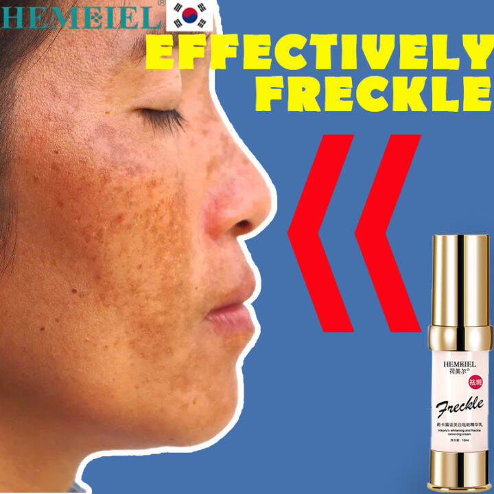 HEMEIEL Dark Spots Remover Melasma Removal Cream Original Set Melasma