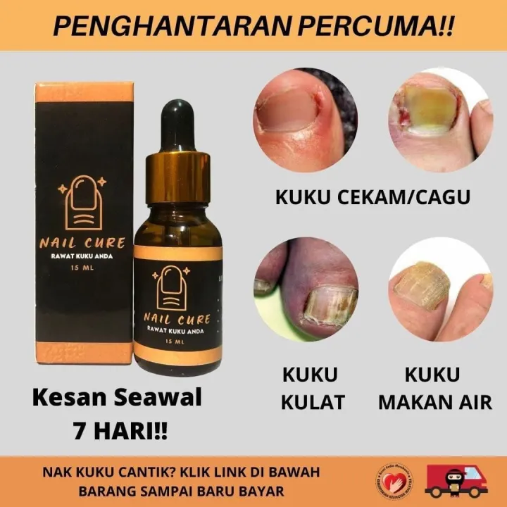 Ubat Kuku Rosak Nail Cure Lazada