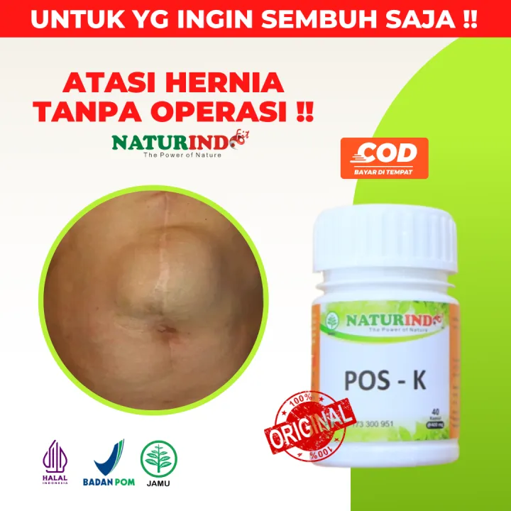 Obat Hernia Dijamin Paling Ampuh Turun Berok Buah Zakar Bengkak Nyeri