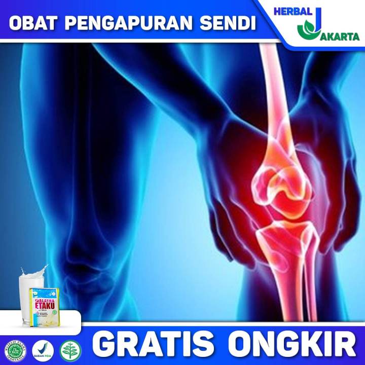 Obat Pengapuran Sendi Pengapuran Sendi Lutut Pengapuran Tulang Kaki