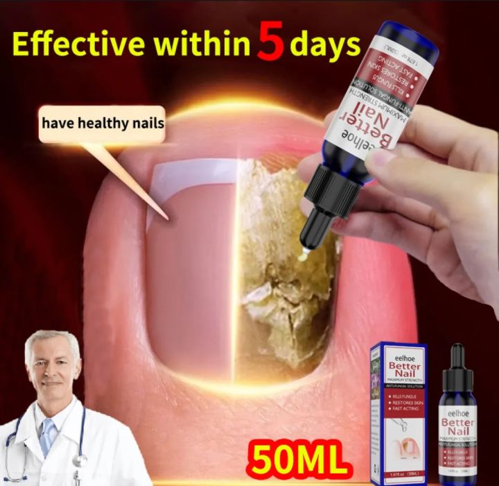 Eelhoe Nail Fungal Solution Nail Treatment Solution Foot Anti Fungal