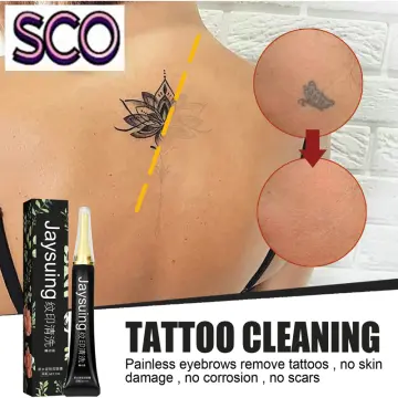 Aggregate Eraser Tattoo Removal Cream Latest Tnbvietnam Edu Vn