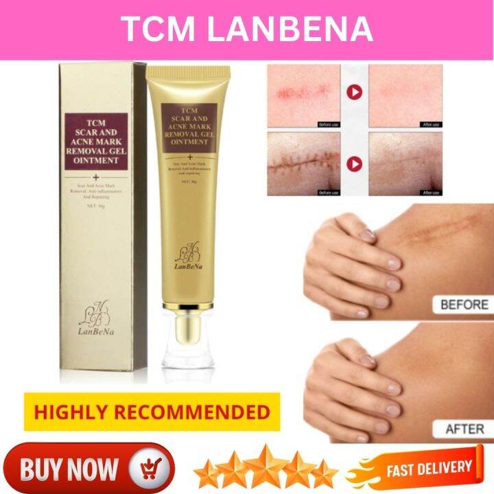 Tcm Lanbena Scar Removal Gel Cream Acne Pimple Marks Removal For