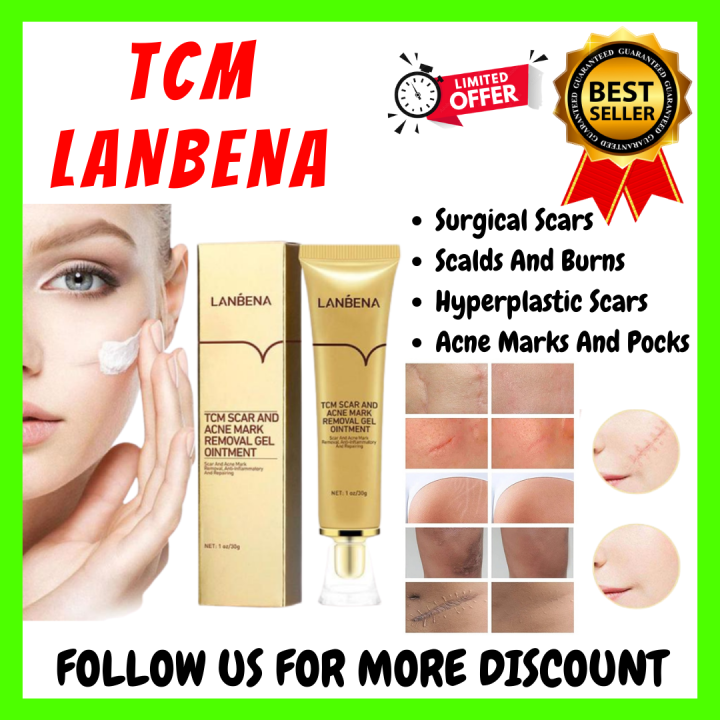 TCM LANBENA Scar Removal Cream 30g Acne Treatment Acne Control