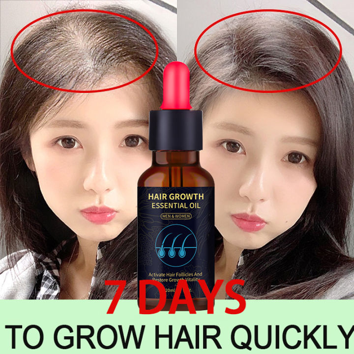 Effective Minoxidil Hair Grower Serum Original Hair Growth