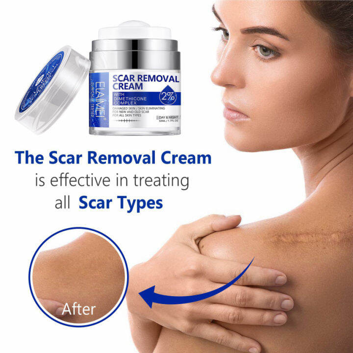 Elaimei Skin Scar Removal Cream Scar Repair Cream Reduce Scar Area