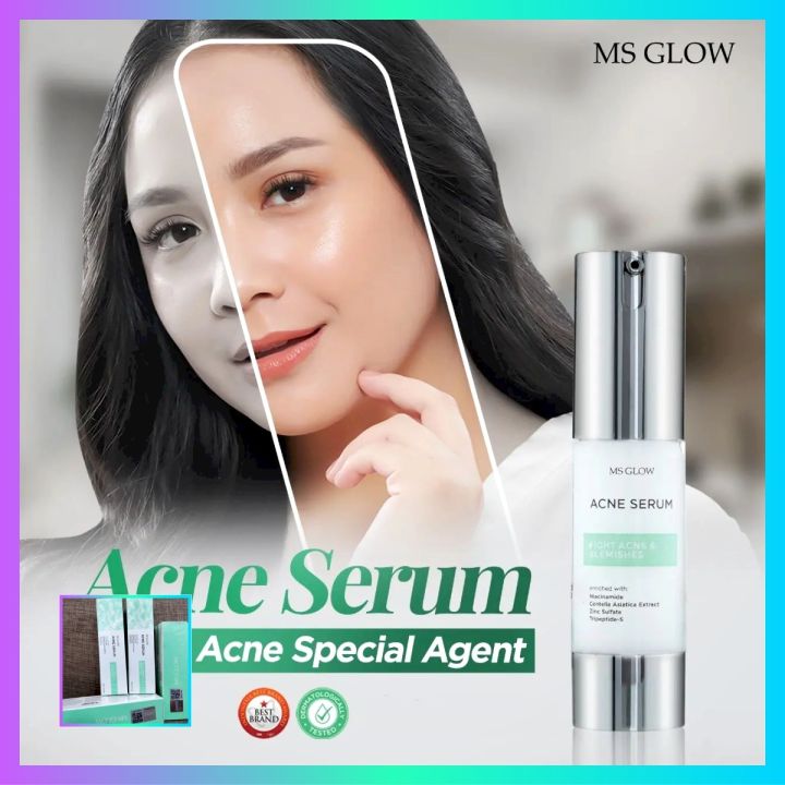 Acne Serum Ms Glow Kemasan Baru Berhologram Penghilang Jerawat Lazada