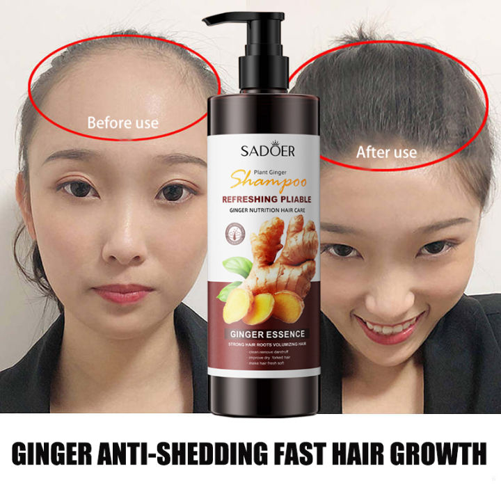 SADOER Ginger Hair Moisturizing Smooth Care Hair Shampoo Anti Hair Loss