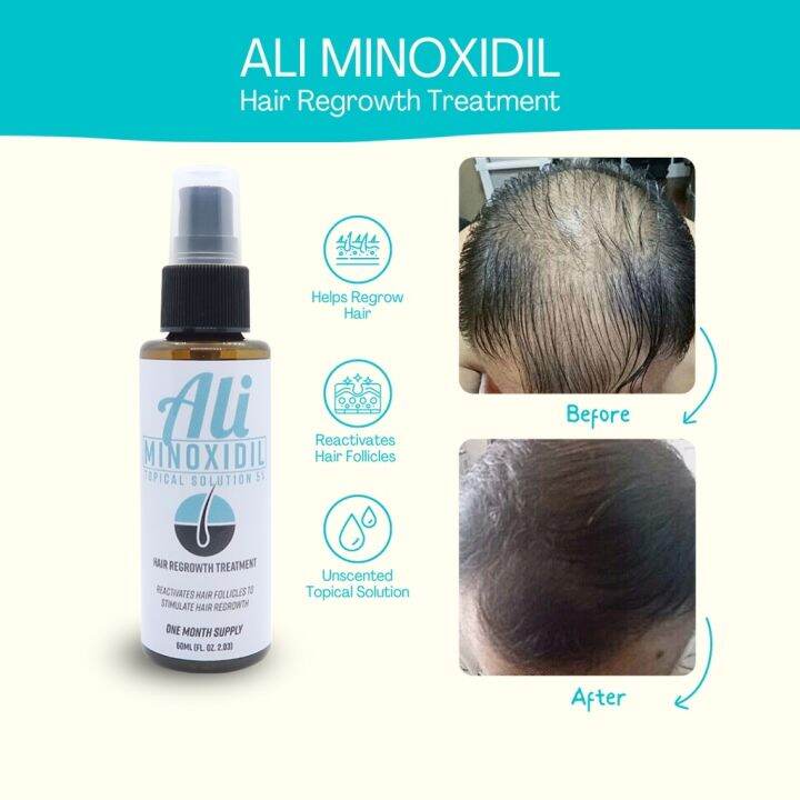 AJDL SellEQWS PH Ali Hair Grower Minoxidil 5 Hair Growth Treatment 60ml