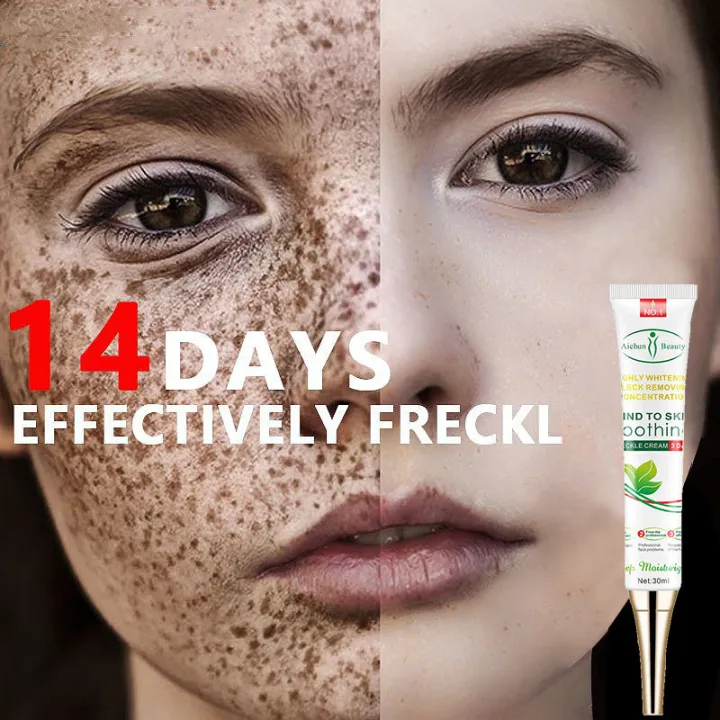 Whitening Freckle Dark Spot Remover Melasma Cream Cream For Face