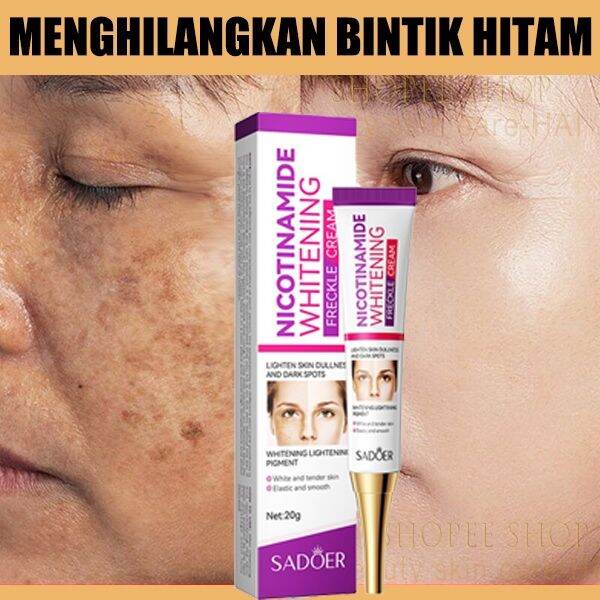 Krim Bintik Melasma Bpom Krim Wajah Flek Hitam G Krim Wajah Glowing