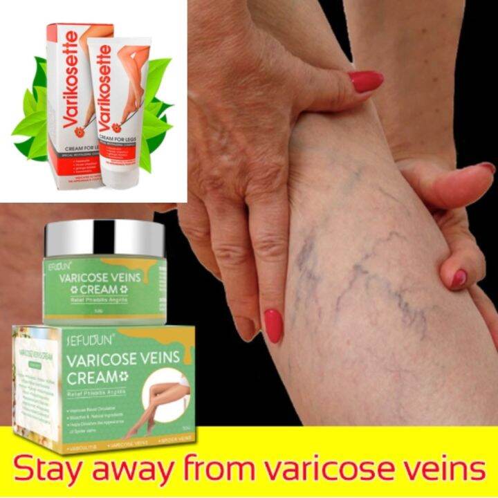 Original SEFUDUN Varicose Vein Treatment Cream Spider Vein Pain Lazada PH