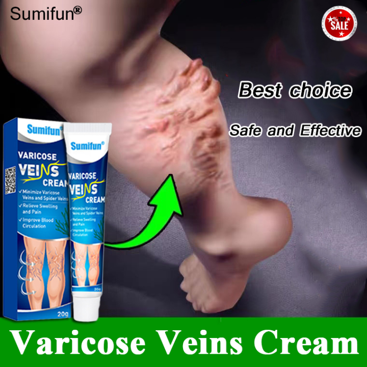 Local Delivery Sumifun Varicose Veins Remover Effective Original