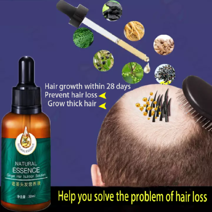 Ready Stockfast Hair Growth Ginger Hair Nutrient Solution Hair