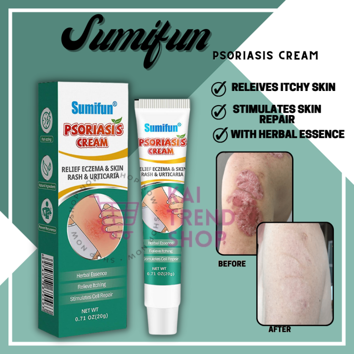 Psoriasis Sumifun Eczema Cream Antibacterial Anti Itching Herbal