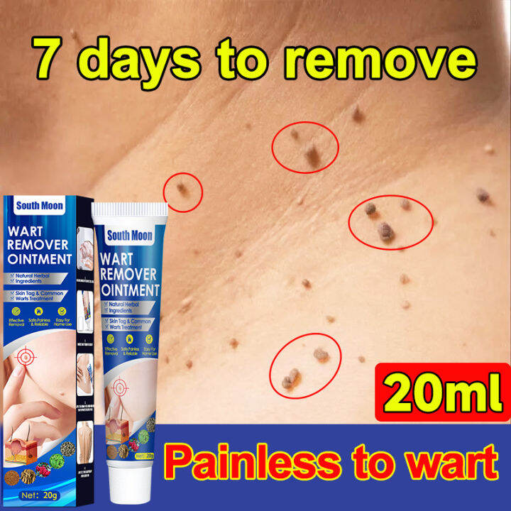 Warts Remover Original Cream Warts And Skin Tags Remover Mole Remover