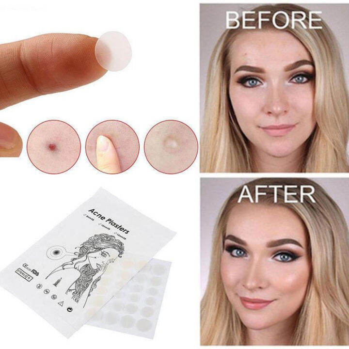 36 Pcs Pimple Patch Sticker Waterproof Acne Patch Invisible Acne