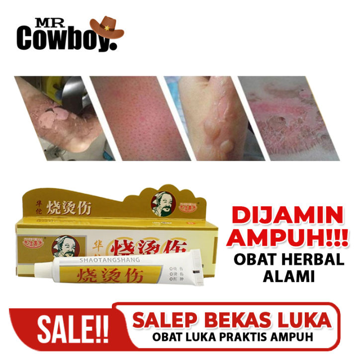 Obat Luka Bakar Obat Luka Agar Cepat Kering Salep Penghilang Luka