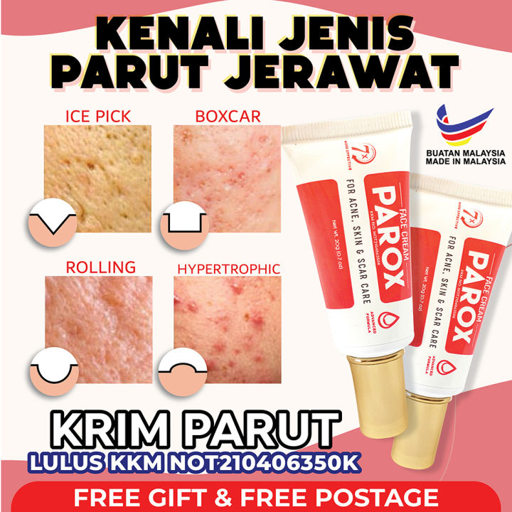 Krim Parut Muka Jerawat Jeragat Untuk Muka Dan Kulit Krim Parox Lulus