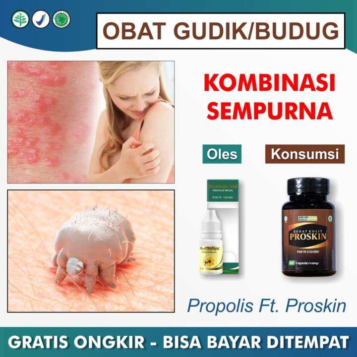 PRIVASI Obat Budug Seluruh Badan Gatal Penghilang Korengan Scabies