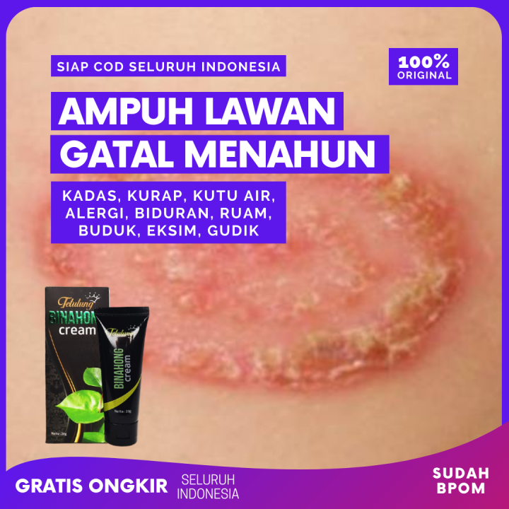 Paket Salep Binahong Cream Gr Sabun Binahong Salap Gatel Kulit