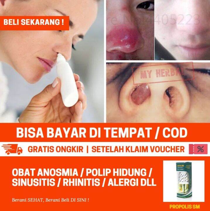 Obat Hilang Indera Penciuman Dan Rasa Obat Tetes Kehilangan Indra