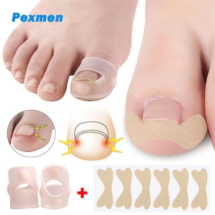 Pexmen Pcs Ingrown Toenail Corrector And Sticker Big Toe Nail Healing