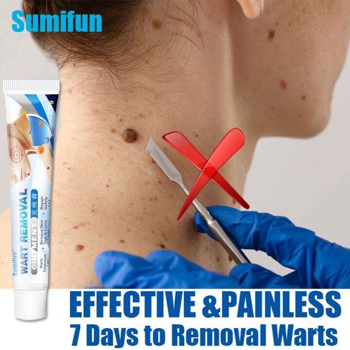 Sumifun Warts Remover Cream Herbal Wart Treatment Wart Removal