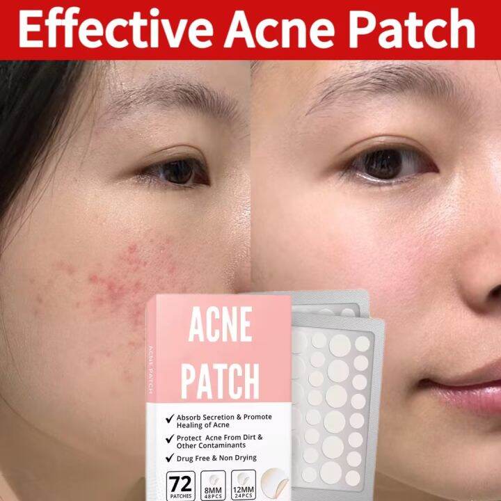 Effective Acne Patch Pcs Waterproof Acne Repair Removes Acne Scars