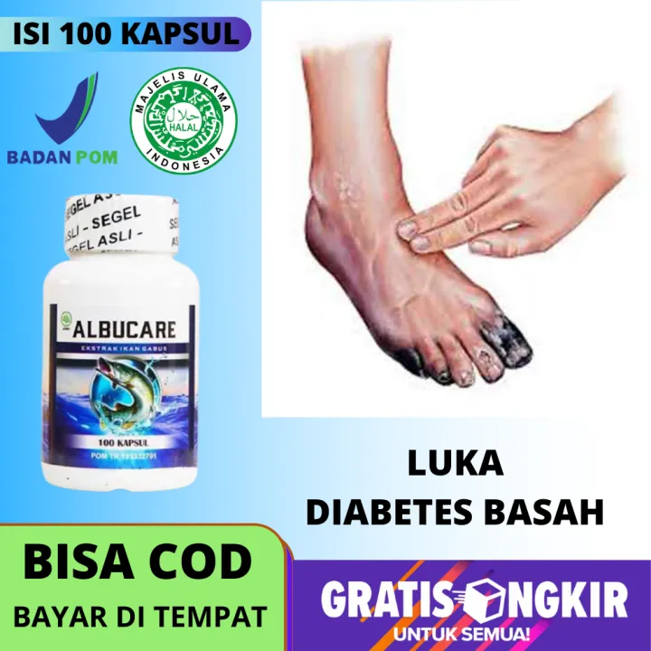 Obat Pengering Luka Diabetes Mengeringkan Luka Diabetes Melitus Basah