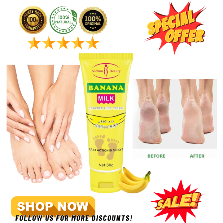 Banana Foot Cream REMOVES ODOR FEET Best Selling Fast And Effective