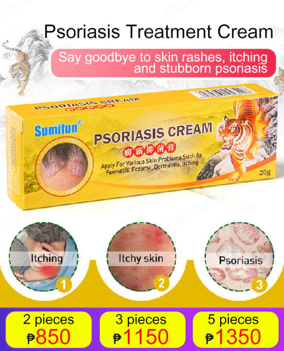 Sunrichh Topical Skin Care Gel For Tinea Manuum Tinea Pedis Psoriasis