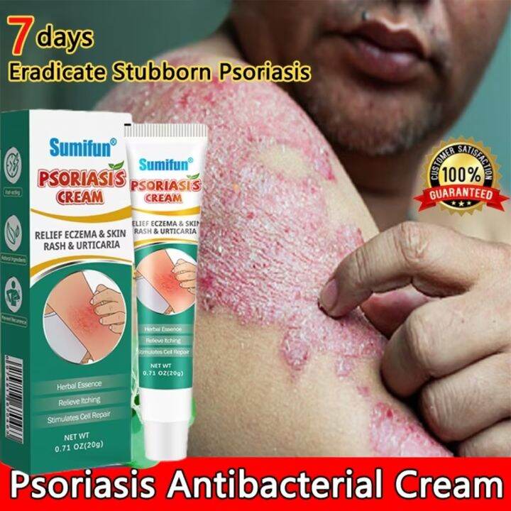 Sumifun Eczema Treatment Cream Atoderma Cream Original Gamot Balat